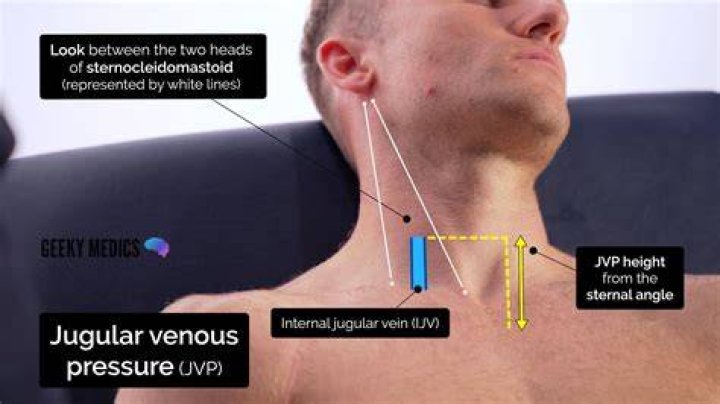 Why do we measure JVP